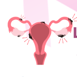 Image - Journées prévention cancers